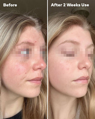 MakeUp Eraser® Silver Clear Skin Cloth