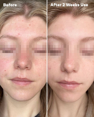 MakeUp Eraser® Silver Clear Skin Cloth