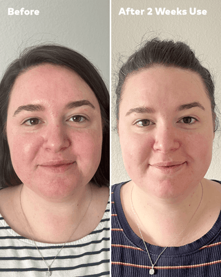 Before and after comparison of a woman's face with text indicating time elapsed.